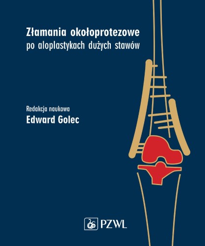 Przejdź do produktu ZŁAMANIA OKOŁOPROTEZOWE PO ALOPLASTYKACH...