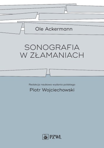 Przejdź do produktu SONOGRAFIA W ZŁAMANIACH, OLE ACKERMANN