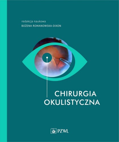 Przejdź do produktu CHIRURGIA OKULISTYCZNA, BOŻENA ROMANOWSKA-DIXON