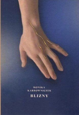Blizny, Monika Karbowniczek